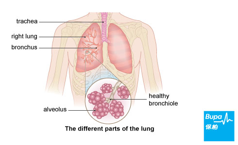 Asthma in children_Lung-Eng