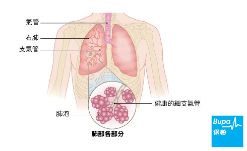 Asthma in children_Lungs-Chi