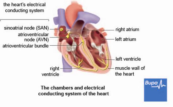 Types of arrhythmia