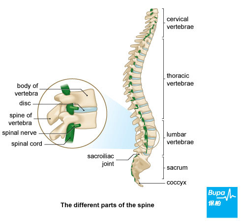 back pain
