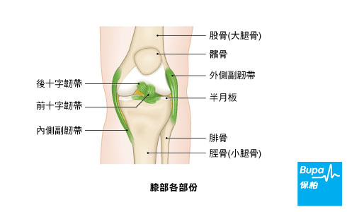 膝關節置換