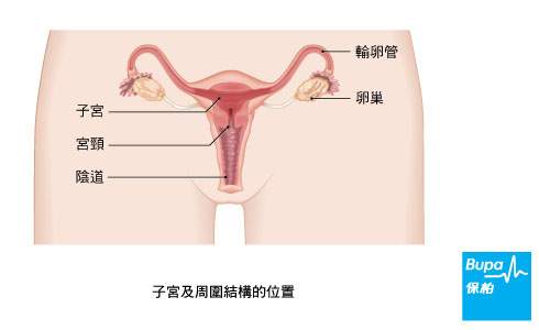 卵巢癌