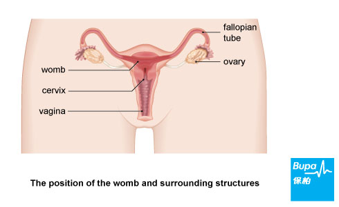 ovarian cancer