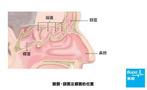 Type of sinuses