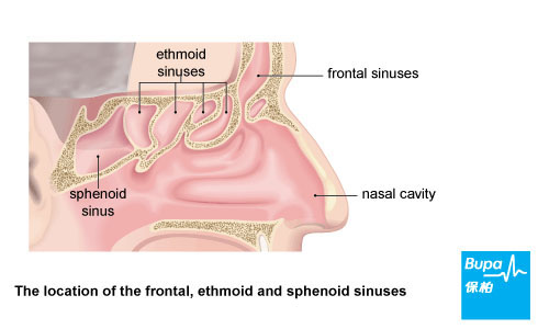 Type of sinuses
