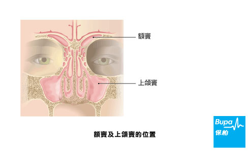 Type of sinuses