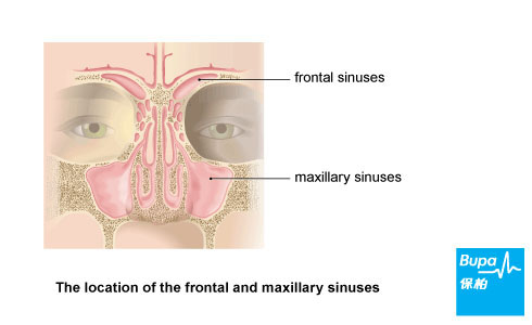 Type of sinuses